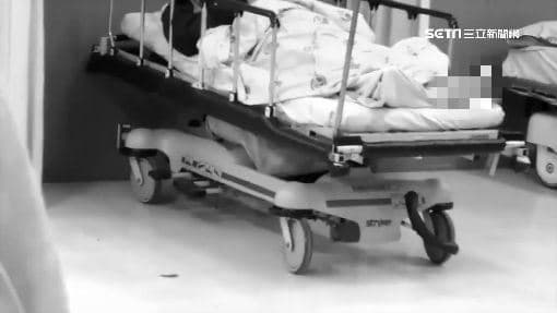 抽菸老翁左腿截掉、右腳剩拇趾 醫曝5警訊