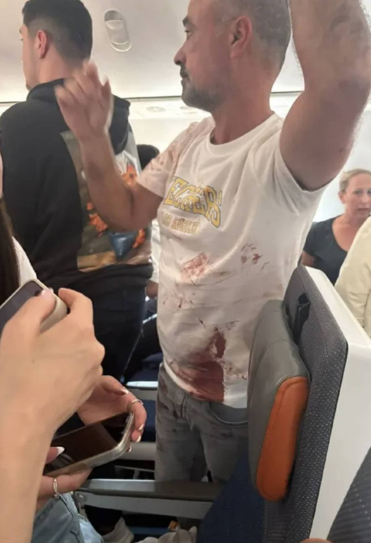 疑似為機師在機上發生暴力衝突，其中一名出面制止的乘客身上沾滿血跡。（翻攝X）
