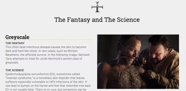 圖|Samwell Tarly 嘗試治療 Sir Jorah Mormont 的灰鱗病。