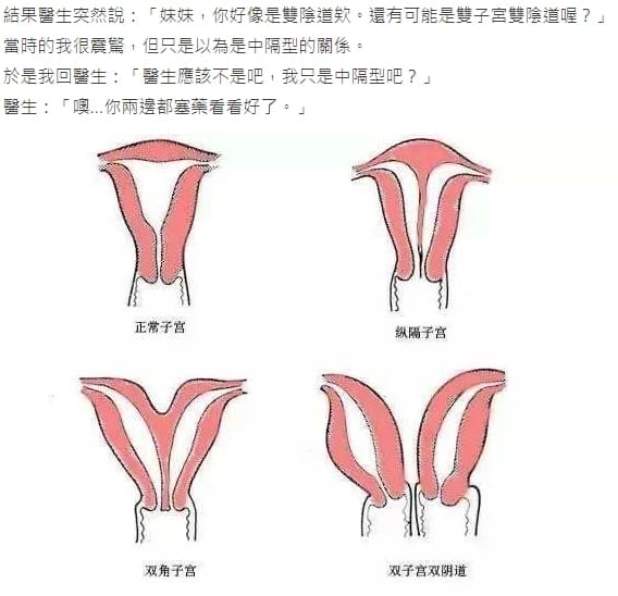 為陰道疾病就醫後,這名女網友被婦產科醫師判定可能是「雙子宮雙陰道」。(翻攝自Dcard)