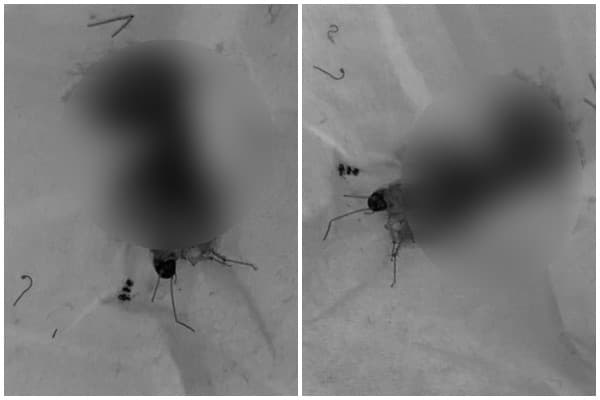 網友打死蟑螂後,竟然噴出「紅色鮮血」,讓他感到十分不解。(翻攝自「爆廢公社公開版」臉書)