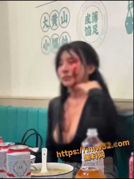 黑衣妹掛彩。(翻自《黑料網》)