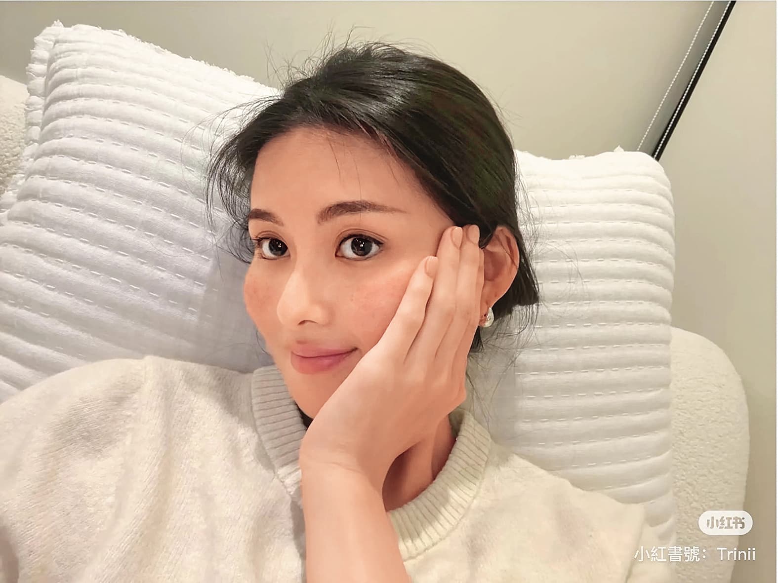 廖思惟分享自己得了玫瑰疹,也暖心回覆網友的留言和意見。 (翻攝自廖思惟小紅書)