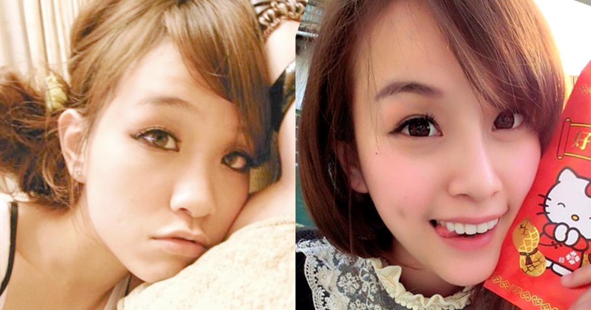 美麗見證(一)：經過醫師專業建議，塌鼻挺起來，變身為五官立體美女。 (首席醫美授權提供)
