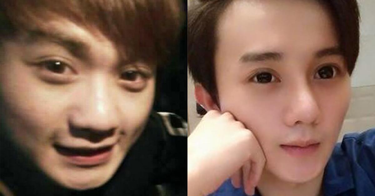 美麗見證(三)：經過醫師專業建議，鼻挺帥氣度加分，躍身成為男模等級。 (首席醫美授權提供)